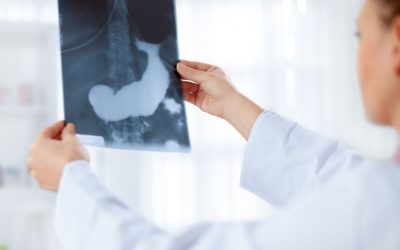 Conoce más sobre el insulinoma