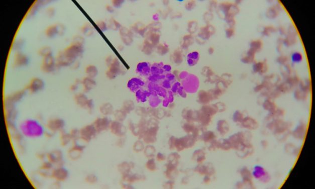 Conoce cómo la diabetes  tiene una estrecha relación  con la psoriasis