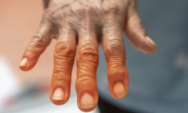¿Existe relación entre la diabetes y la artritis reumatoide?