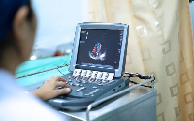 La ecocardiografía predice mejor el riesgo cardiovascular en pacientes con diabetes